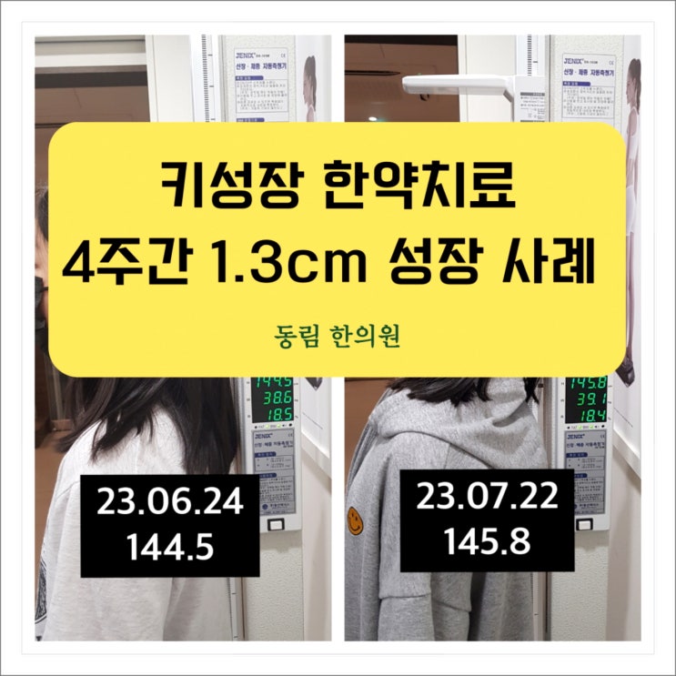  4주 한약치료로 1.3cm 키 성장한 후기