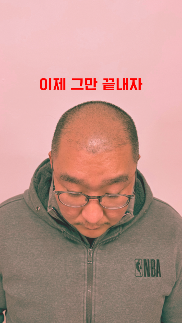  탈모 이제 그만하자!