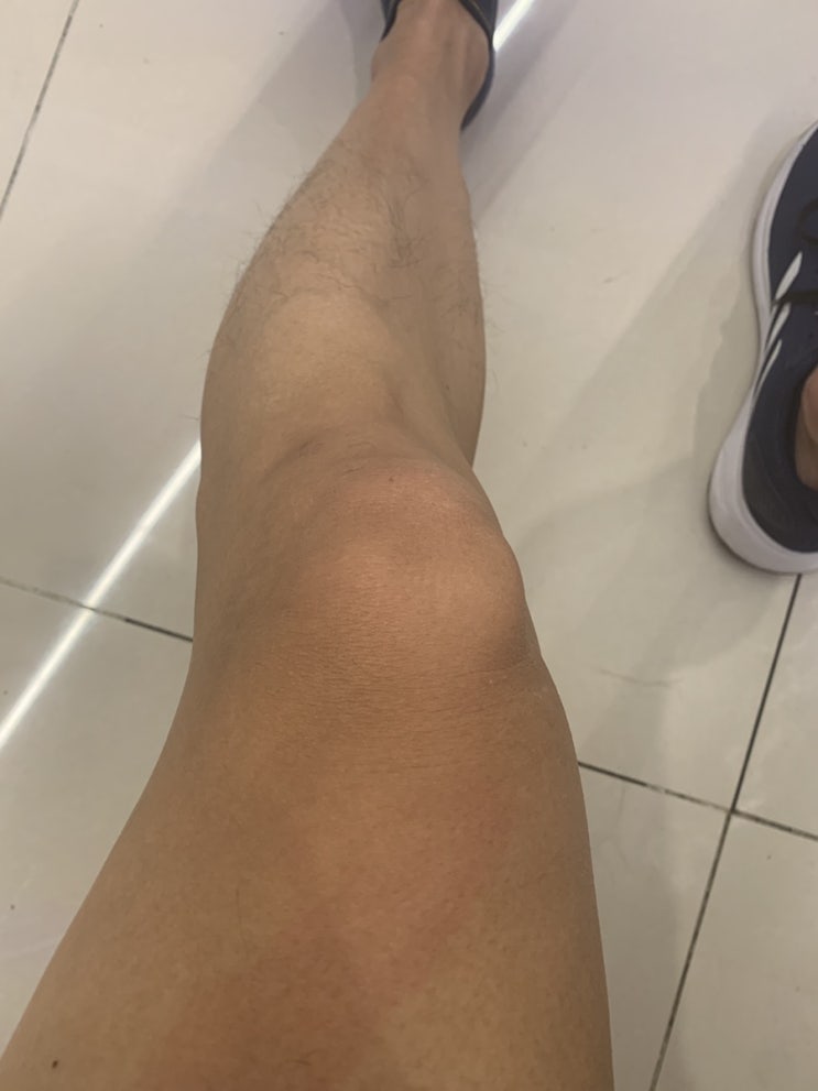  하체 약한 사람은 젊었을 때부터 꾸준히 하체 운동 하라