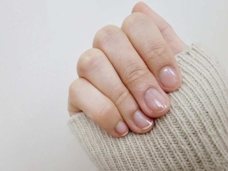 건조하고 갈라지는 손톱엔 손톱영양제 반디 핑크다이아 톤픽스 건조하고 갈라지는 손톱엔 손톱영양제 반디 핑크다이아 톤픽스