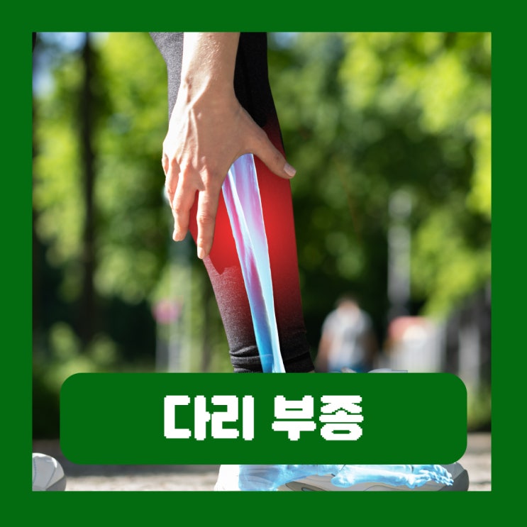  다리 부종 증상 간 신장 질환 원인 하지부종 치료