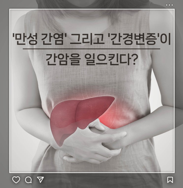  '만성 간염' 그리고 '간경변증'이 간암을 일으킨다?
