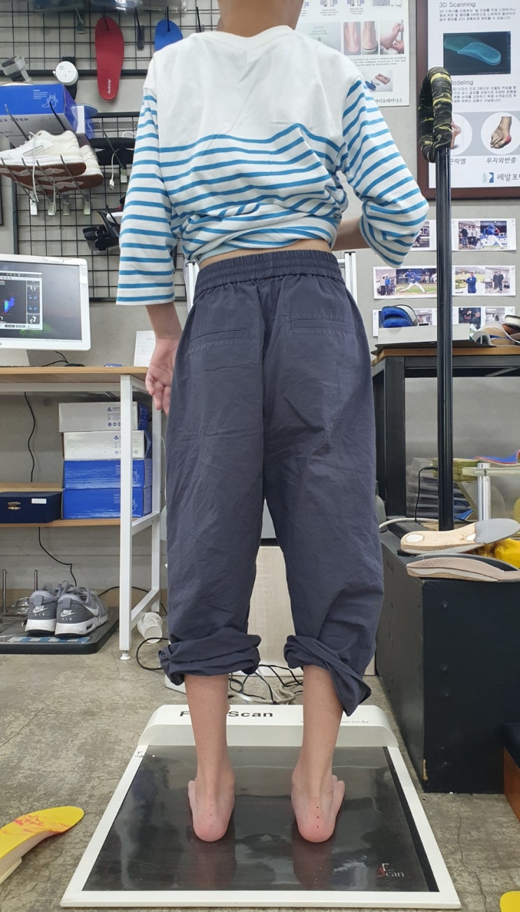  성장기 좋지 않은 걸음걸이나 다리 길이 차이는 척추 건강을 위해 빨리 해결해 줘야 합니다.