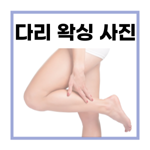  다리 왁싱 시술 전후 사진 - 마산 왁싱샵 마이뷰티