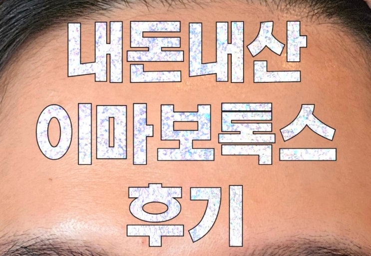  내돈내산 이마보톡스 후기 (일주일의 변화)