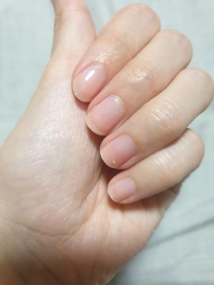  손톱영양제 추천 반디 핑크다이아 톤픽스로 손상손톱을 튼튼하게!