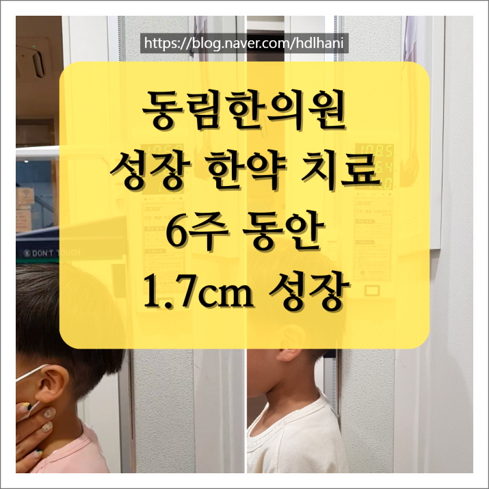  6주간 1.7cm, 또래 보다 높은 성장 속도 사례