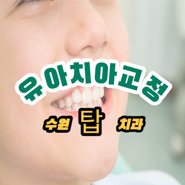 유아치아교정 중요한시기와 알아두면 좋은점