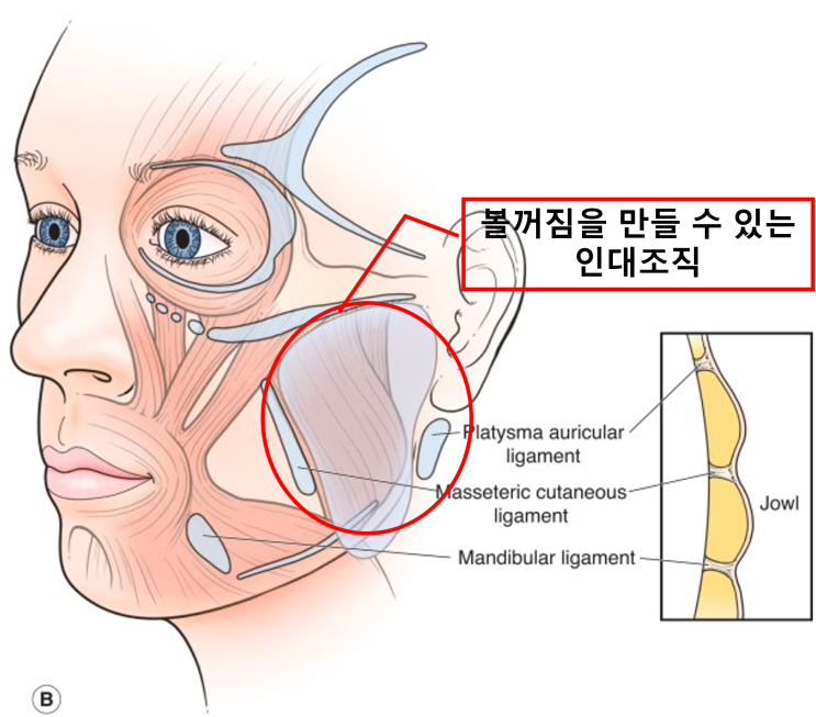  실리프팅 후 볼 패임과 광대 부각, 원인과 해결 방법은?