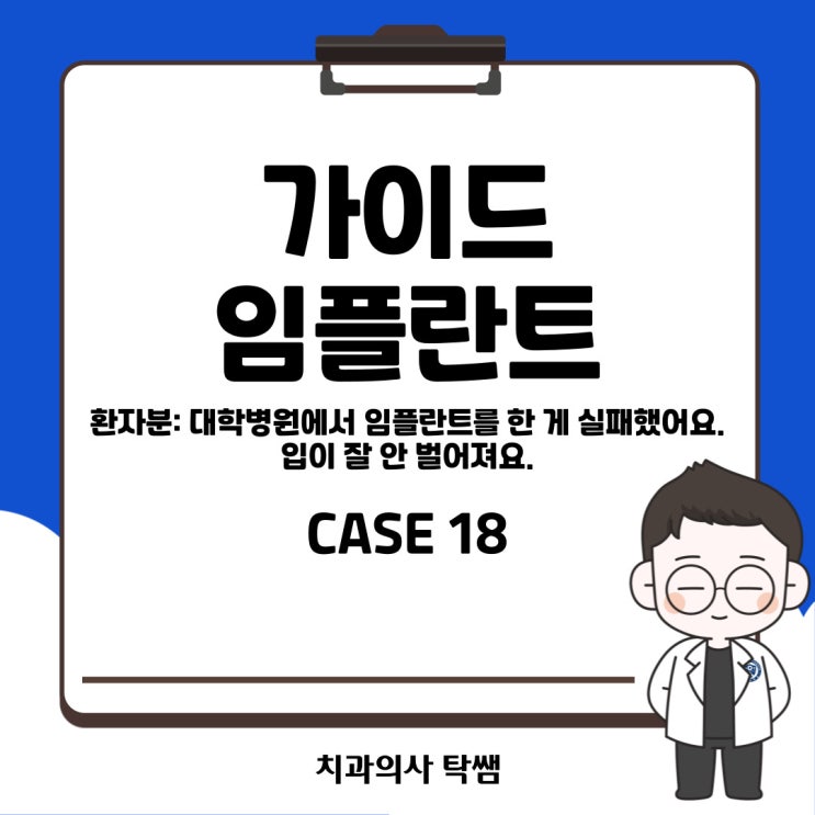  [탁쌤 CASE 18] 청주 개구량 작은 환자에서의 가이드 임플란트 수술