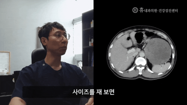 위장관기질종양(GIST) 발견 사례. 정기적인 검진의 중요성.
