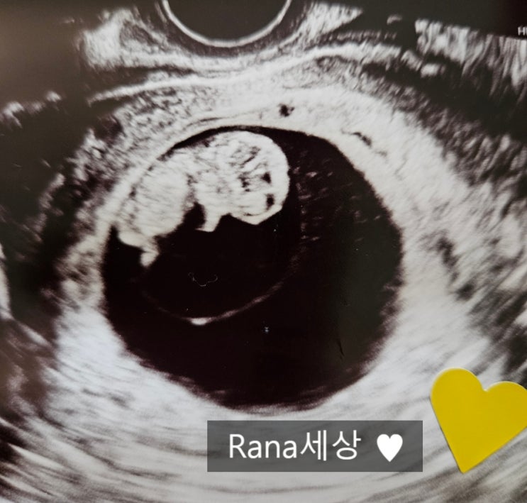  [임신일기] 임신 9주차, 대망의 차병원 난임병원 졸업 