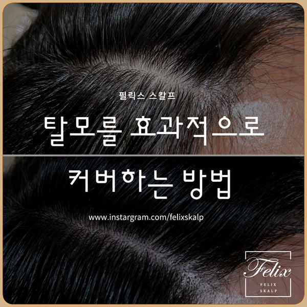  구래동 두피문신 탈모커버를 위한 가장 현명한 선택!