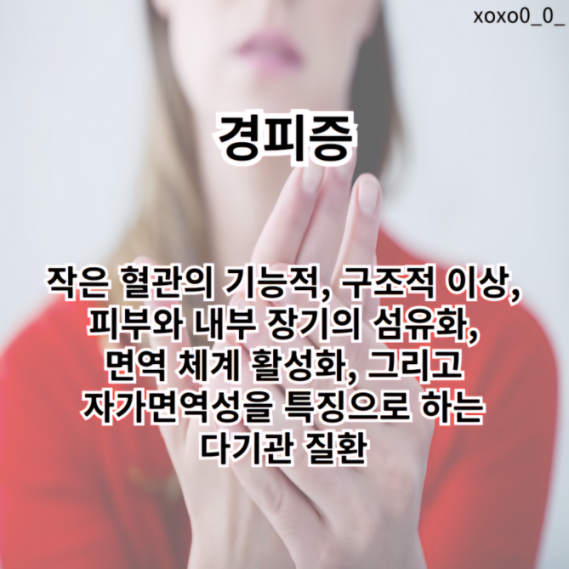 경피증: 원인, 증상, 치료