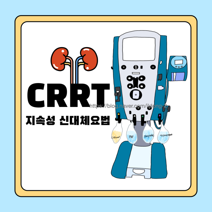  [CRRT] 중환자 투석 지속적 신대체 요법 CVVHDF 모드 적용대상 공부