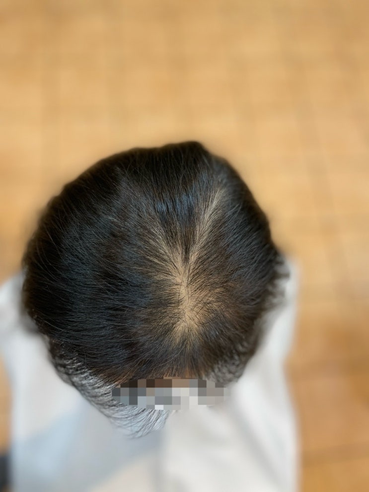  여성탈모환골탈퇴 부산탈모펌 모류교정 잘하는미용실 르네시떼6층 사상홈플러스7층/포항방어진울산양산덕계김해밀양경주진주창원사천화명가야주례개금부전연산동래초량남포부산역사하영도해운대수영망미