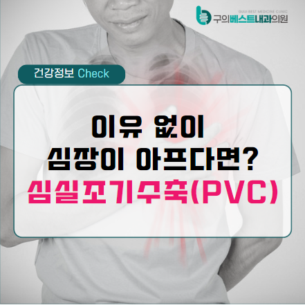 의학용어 PVC, VPC, VES 조기심실수축 진단 방법(심전도 검사)