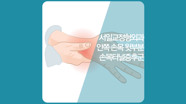 인천손목통증 정형외과-손목위·손목안쪽통증 손목터널증후군(수근관증후군, 마우스증후군)증상