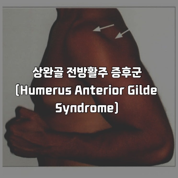  상완골 전방활주 증후근 증상 약해진 근육과 해결방안