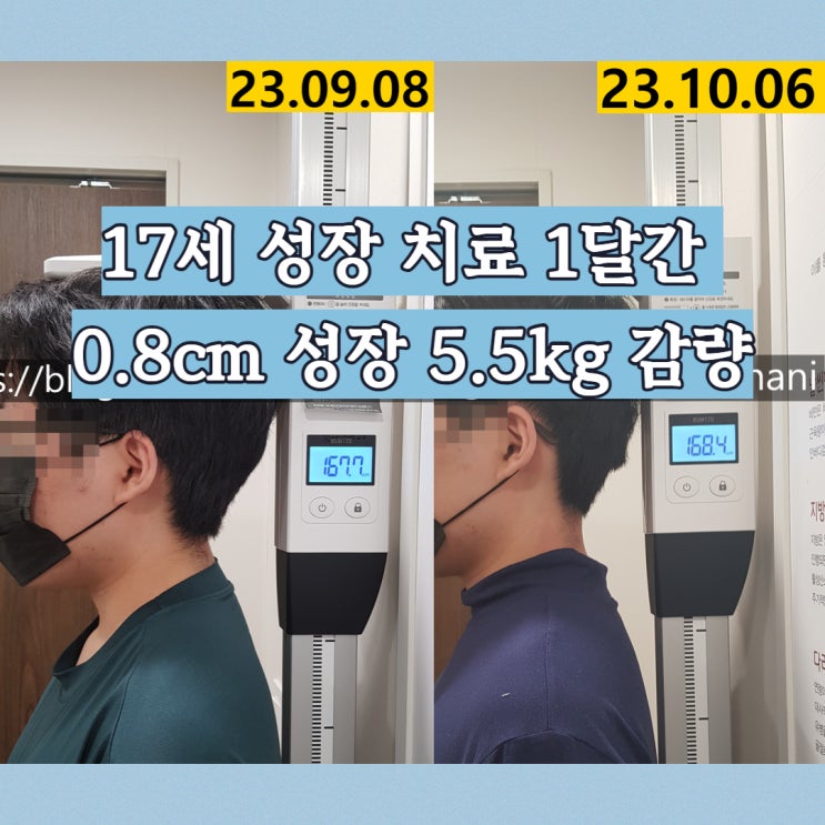  성장과 체중감량을 함께 이뤄진 고등학생 환자분 치료 사례