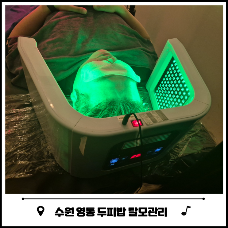 수원 두피 관리, 두피밥에서 탈모 극복 수원 두피 관리, 두피밥에서 탈모 극복