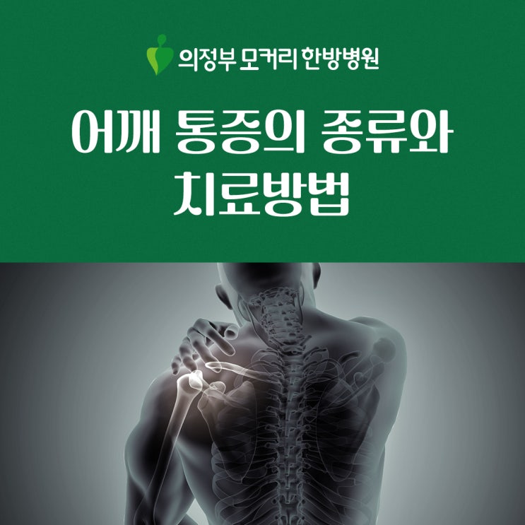  의정부한방병원 어깨 통증의 종류와 치료방법