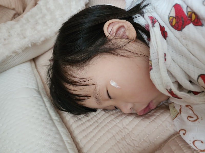 약국 아기 얼굴 멍크림 연고 비판텐보다 이것 추천
