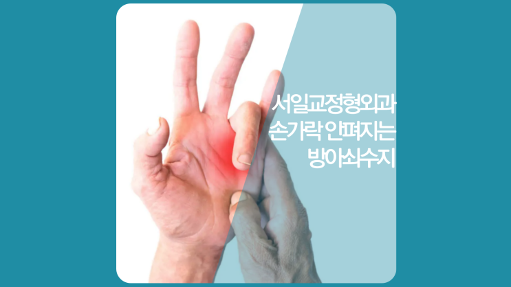  인천 손가락정형외과 손가락 소리나고 안펴짐 방아쇠수지
