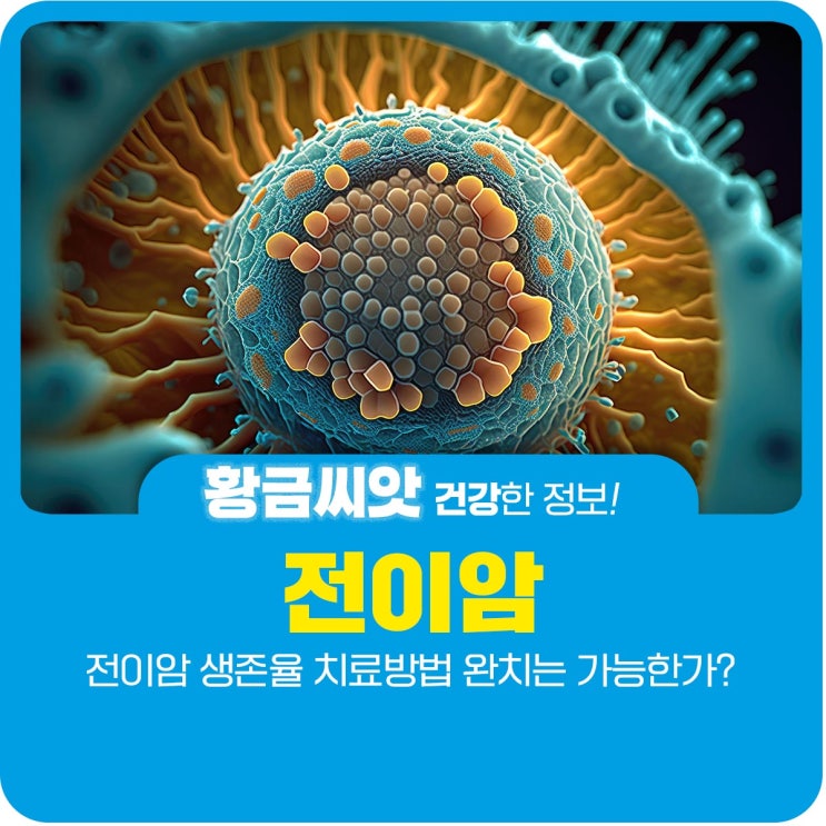  전이암 생존율 치료방법 완치는 가능한가?