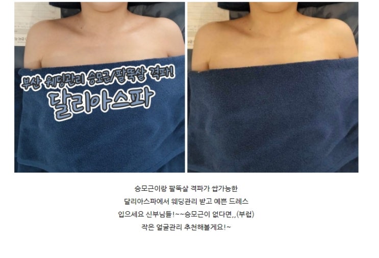  여름 팔뚝살 빼기 신부관리 웨딩관리는 달리아스파by.주바리