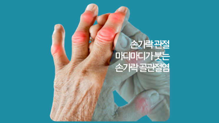  인천수부병원 손가락 마디 관절 부었을때 손가락퇴행성관절염