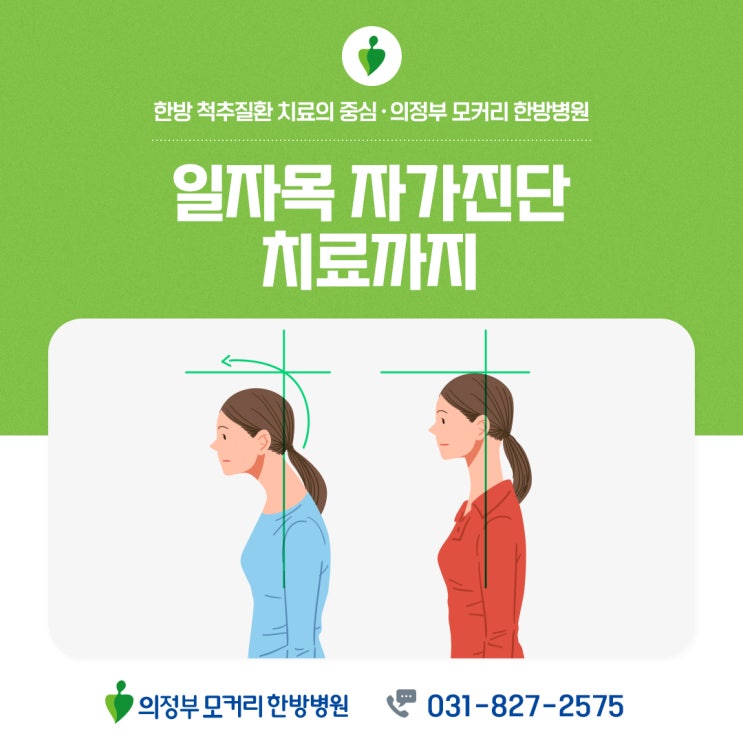  목디스크 전 단계! 일자목 증상과 효과적인 치료법