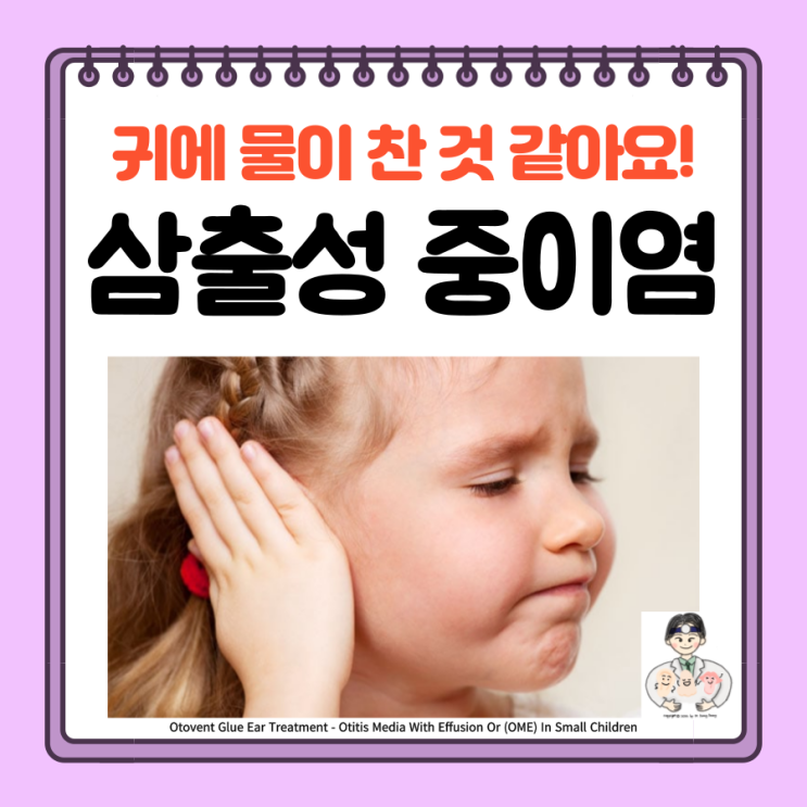  삼출성 중이염, 귀에 물찬 느낌, 원인 증상 치료 항생제 수술