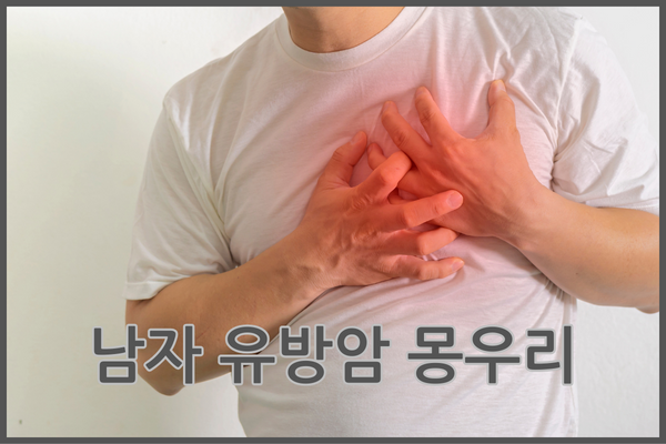 남자 유방암 몽우리