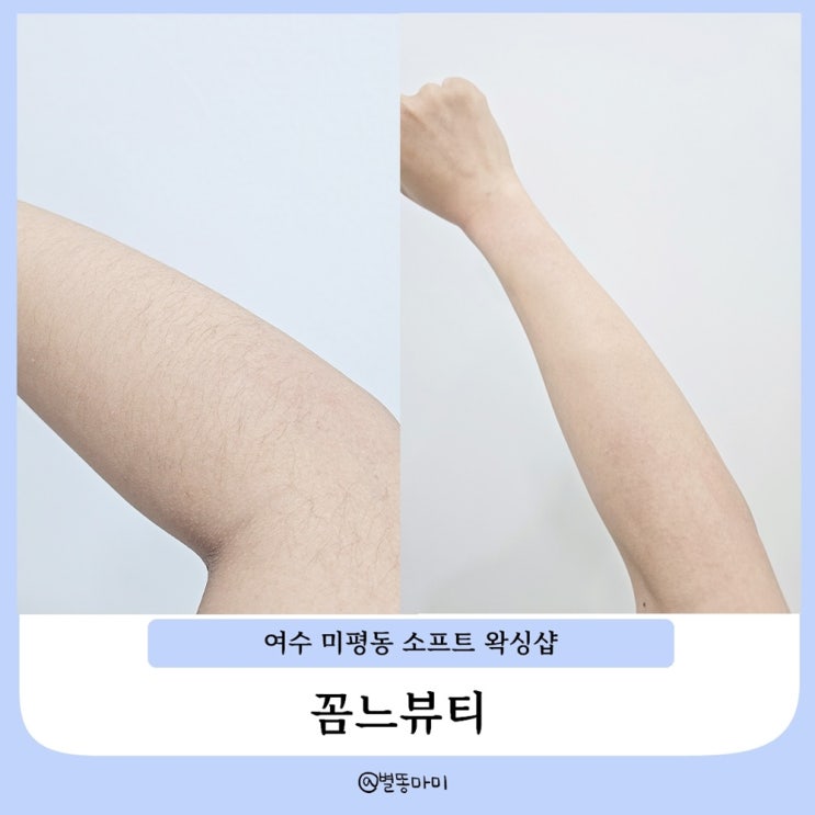  여수왁싱 여름맞이 소프트 팔 왁싱 미평동 꼼느뷰티