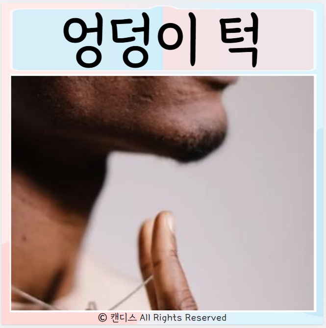  엉덩이턱 관상 원인 유전 개선방법