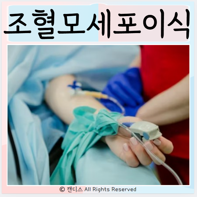  조혈모세포이식 만성 장숙주 종류 증상