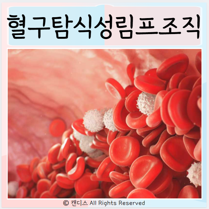  혈구탐식성 림프조직 구증 증상 치료  원인은?