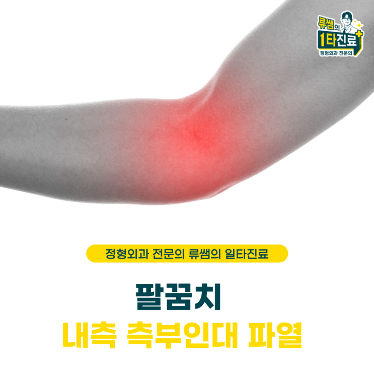  축구하다가 넘어지면서 팔꿈치 통증/ 팔꿈치 인대파열/측부인대파열(의사작성)