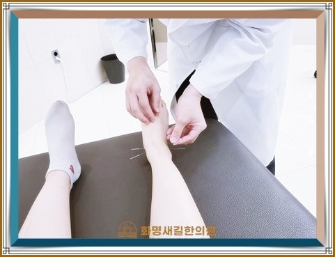  부산체형교정 지간신경종 초기에 잡아야