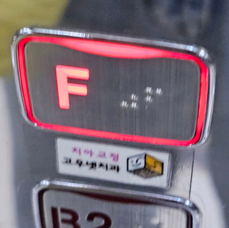  [고우넷치과] 앞니에 철길 다시 깔기...마지막을 향해서