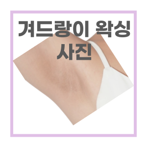 마산 겨드랑이 왁싱 시술 전후 사진 - feat 창동 마이뷰티