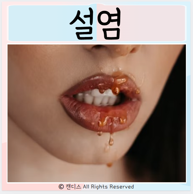  설골 설유두 설소대 혀 질환 설골 증상 설염