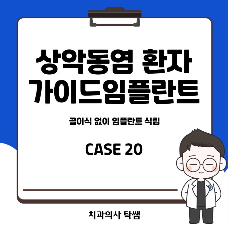  [탁쌤 CASE 20] 청주에서 상악동염(축농증)이 있는데 임플란트 식립이 가능하다고요?