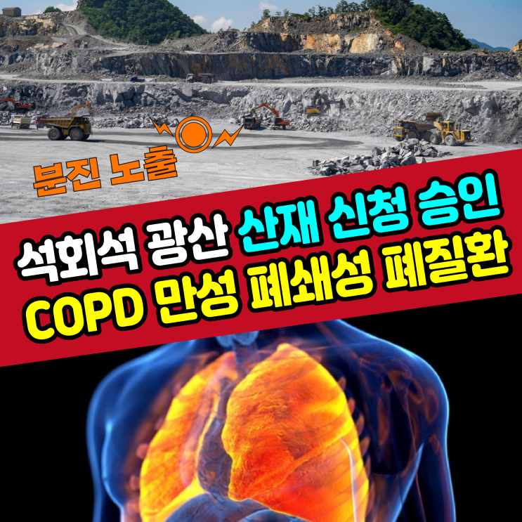  [COPD] 만성 폐쇄성 폐질환 산재 신청 승인(석회석 광산 근로자)