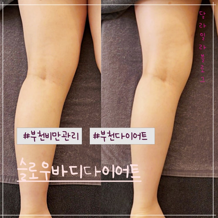  부천비만관리 잘하는 곳  슬로우바디다이어트에서 하체관리