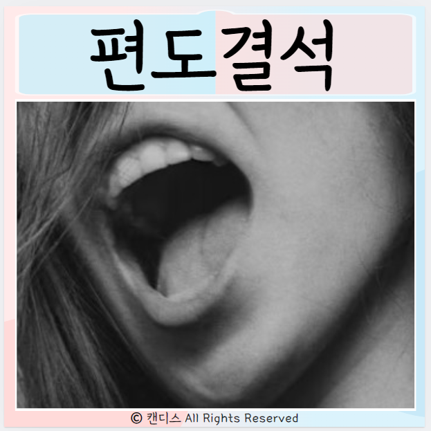  편도결석 원인 제거방법 편도절제술