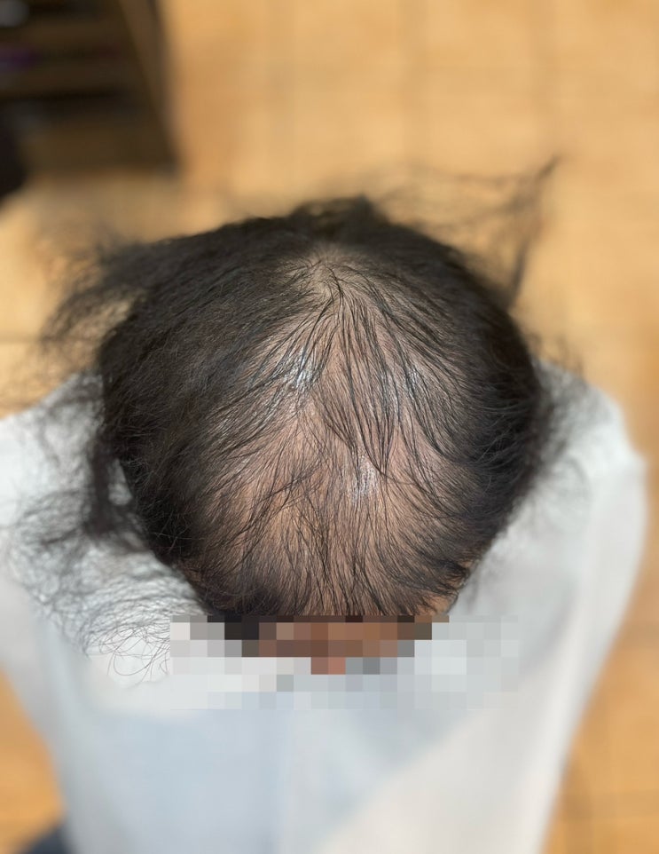  선물같은 탈모성형펌 남/여누구나 기쁨을 부산사상구르네시떼6층사상홈플러스7층미용실[ 경남경북남해거제창원통영구미대구양산울산덕계진해밀양경주대저명지김해화명모라덕천백양수영해운대대연망미초읍]