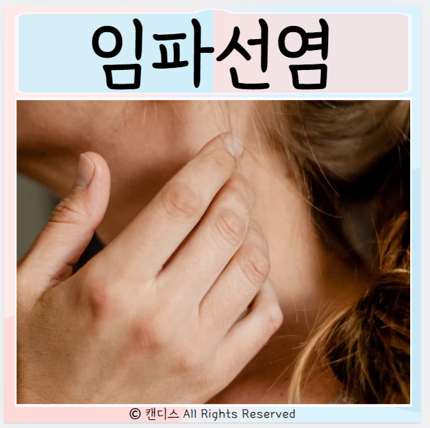 임파선, 림프절 원인 증상 치료방법