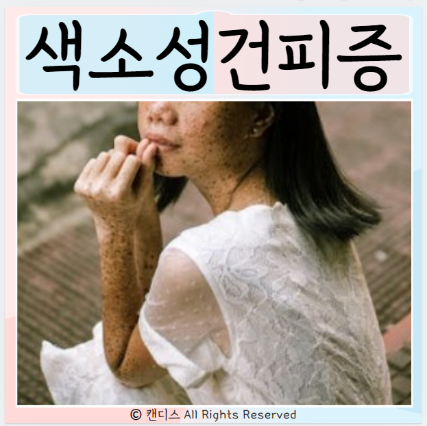  색소성건피증 원인 치료 색소성 양진 증상